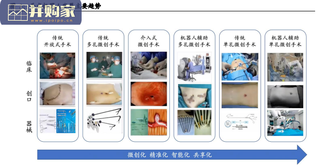 手术机器人行业报告(59页)-第1张图片 手术机器人行业报告(59页)-第1张图片