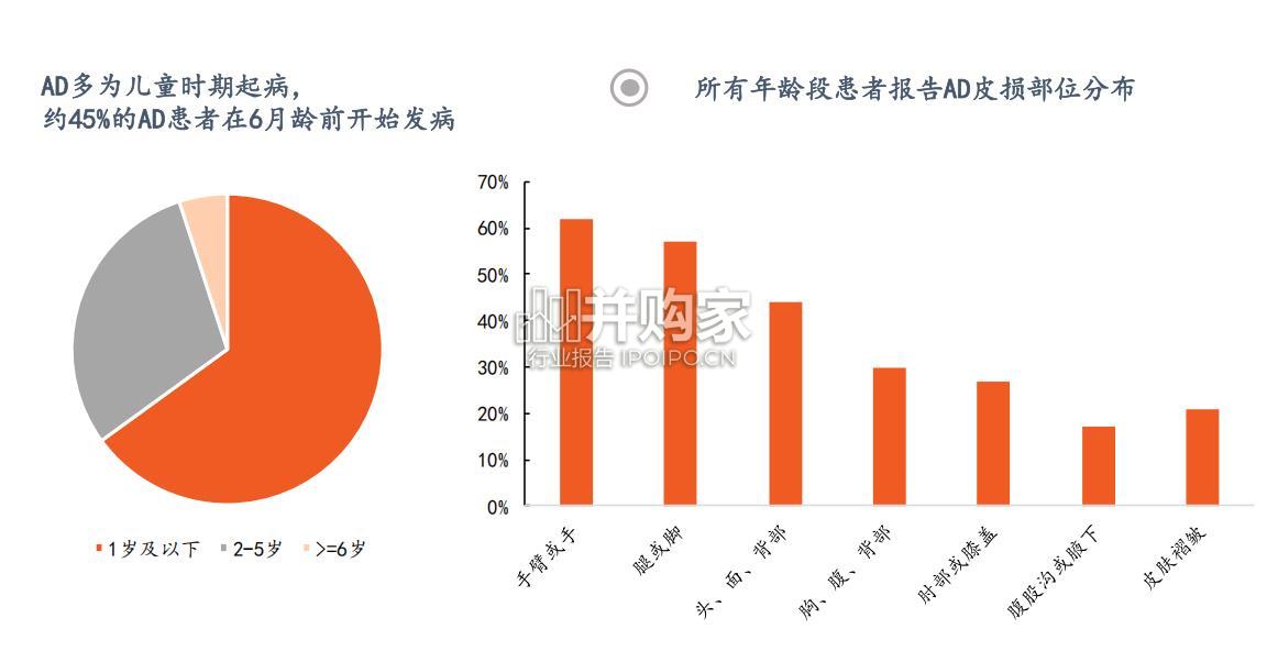 特应性皮炎药物行业报告:全景图(31页)-第1张图片 特应性皮炎药物行业报告:全景图(31页)-第1张图片